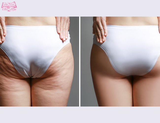 Quần độn mông ôm bụng là “cứu tinh” của những bạn nữ có dáng mông chảy xệ, nhiều mỡ thừa.